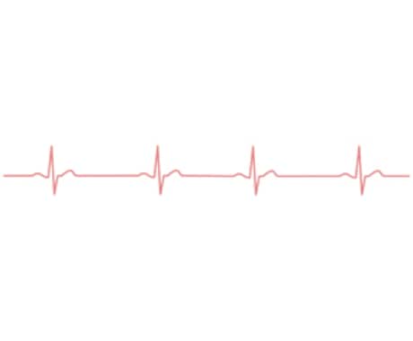 心電図を分かりやすくお答えします 心電図検定受験予定の方、心電図が苦手な方へ イメージ1