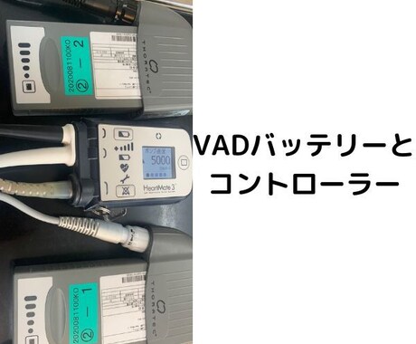 他愛のない雑談OK‼気持のモヤモヤ落ち着かせます 心臓移植待ちの明るい弱者がどんな愚痴でも付き合います イメージ2