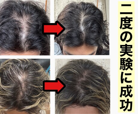 男性限定⚠️薄毛を改善させる方法をご提供いたします メンズの薄毛を徹底改善✨9割の増毛効果の実績✅ イメージ2