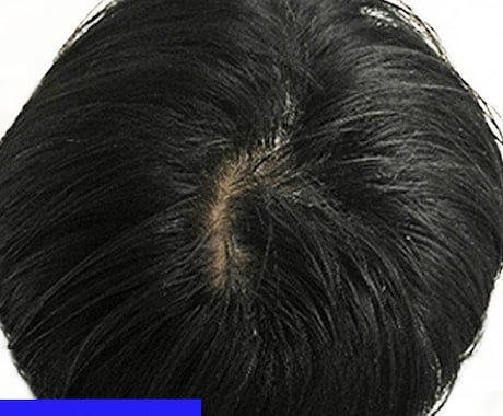 薄毛改善の方法を教えます 申し訳ありません...これでダメならもう元には戻せません イメージ2