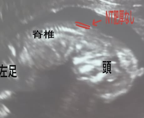周産期、超音波専門医がエコーの確認、解説をします これはなにを見ているのかなど、胎児エコーを詳しく解説。 イメージ2