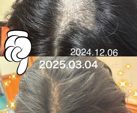 抜毛症専門！あなたの気持ちに寄り添います 長年抜毛症と戦ってきました。共に頑張りましょう。 イメージ1