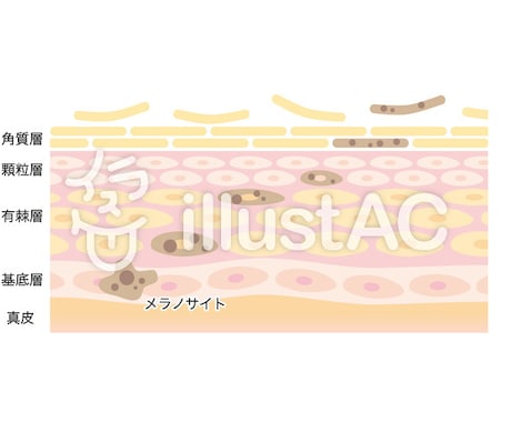 肌荒れ治療にベストな化粧品を肌画像から紹介します 大学の研究室であなたの肌画像を分析します！ イメージ1