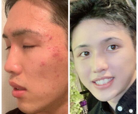 スキンケア・ボディメイクのサポートします 脱"今の自分"新しい自分見つけませんか？ イメージ1