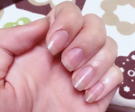 爪でお悩みのあなたに教えます 爪がコンプレックスで手を出すのが恥ずかしい方にちょっとした、 イメージ1
