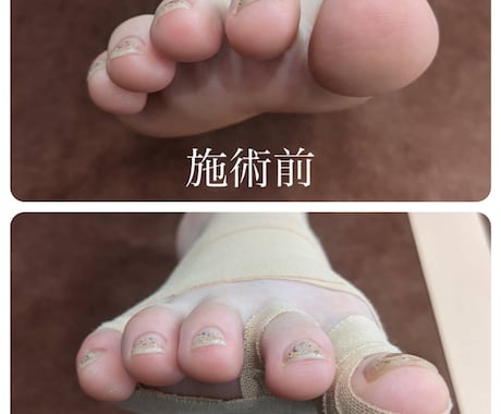足から全身代謝を上げる足テーピングをお伝えします 足の歪みは全身の歪みとなり代謝不良に。足テーピングレクチャー イメージ1