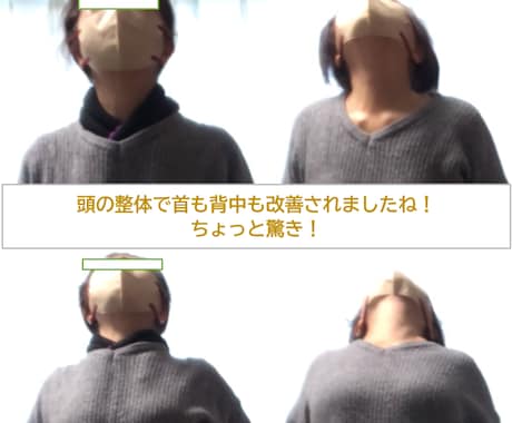 大好評「頭の整体」一緒にやります、教えます 頭には沢山の感覚センサーがあります、再起動を体感してほしい！ イメージ2