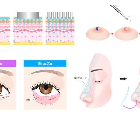 医療用イラスト作成いたします 医療用のイラストをお手軽なお値段で作成致します！ イメージ2