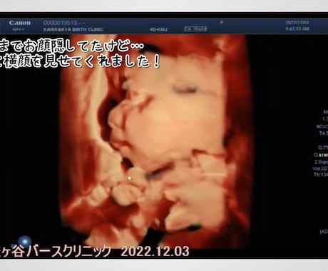 大切な赤ちゃんとの思い出DVD化します 大切に育んだ小さな命の成長記録、エコー動画のメモリアルDVD イメージ2