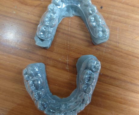 歯科限定　３Dプリントモデル出力します 歯列模型をプリントアウトいたします イメージ1