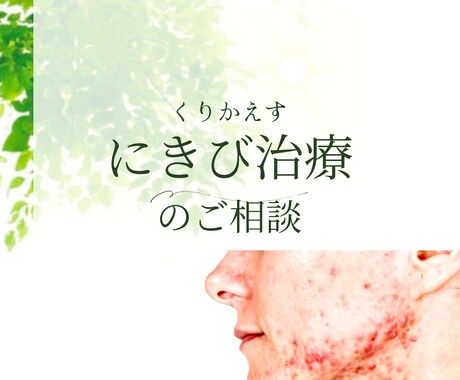 繰り返すにきびの治療スキンケア相談のります 毎回繰り返す、なかなか治癒しないにきびのお悩みありませんか？ イメージ1