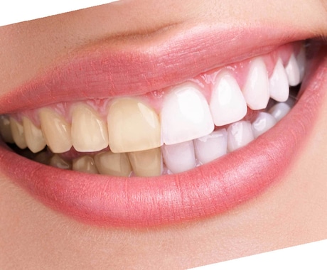歯を白くする画像加工をします 自然な白い歯にします！印象アップに！ イメージ1