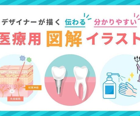 分かりやすい！伝わる！図解・解説イラスト制作します 整形外科・歯科・美容外科様など様々な図解イラストを作成 イメージ2