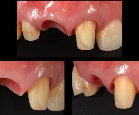 歯科に関する相談。お口の悩みにお答えします 保険診療、自費診療、予防からインプラントまでなんでも答えます イメージ2