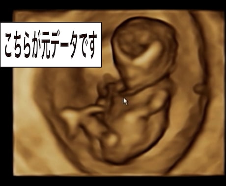 4Dエコーを自然に可愛く修正orイラスト化します 産婦人科専門医が4Dエコーをわかりやすく修正します。 イメージ2