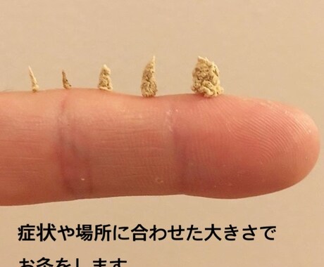 意外と知られていないお灸の使い方教えます イメージ1