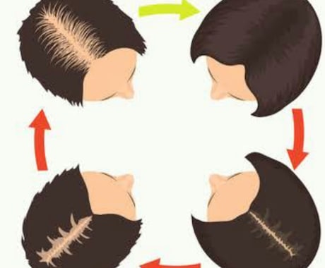 髪を習慣だけで全力で蘇らせます 髪は大切な体の一部です。髪の悩みを解消し充実した人生へ！ イメージ2