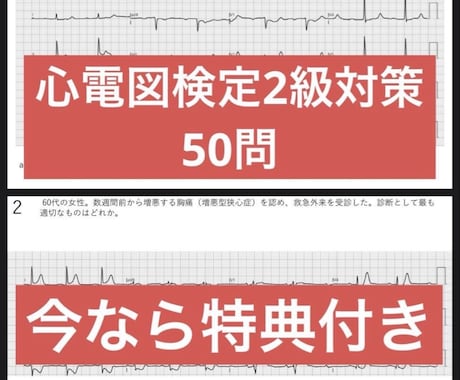 心電図検定2級資格取得サポートをします 心電図検定1級取得者が資格取得サポートをします！ イメージ2
