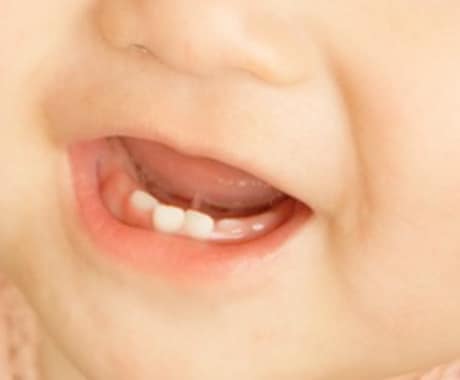 赤ちゃんの歯磨きから永久歯までの歯のお悩み聞きます 赤ちゃんの歯磨きどうやってするの？ イメージ2