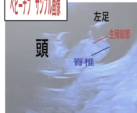 専門医が赤ちゃんの性別予測とエコーの解説をします ベビーナブ対応！11週以降のエコーであれば判定します。 イメージ2