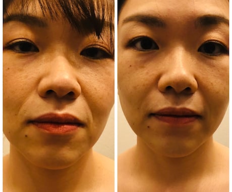 辛い肩首の凝りをほぐしスッキリとした小顔を叶えます たった5分で本当に綺麗になれる！輪郭シェイプケアマッサージ イメージ1