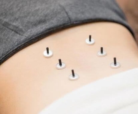 ツボレシピをオーダーメイドで提供します セルフケアで、効果が期待できるツボを症状に合わせてチョイス イメージ1