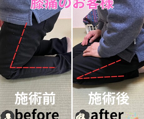 膝痛肩こりがある方に簡単セルフエクササイズ教えます サボり筋を単独収縮させる、革命的エクササイズをお伝えします! イメージ2