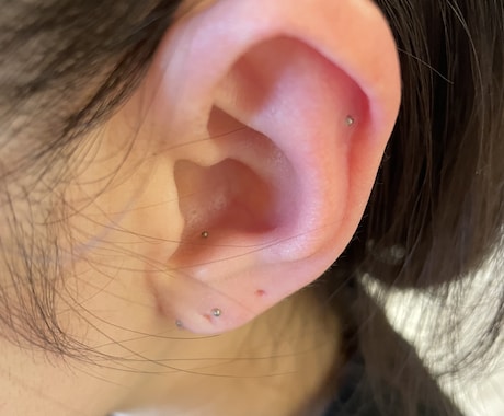 耳ツボ　体の不調な部分のツボお教えします 耳ツボセラピストです♪不調を改善しましょう。 イメージ1