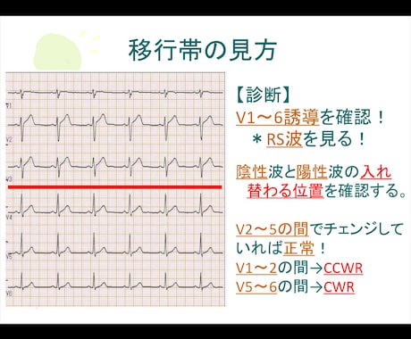心電図の基礎を伝授します 心電図の基礎的な知識をまとめた資料を配布します！ イメージ1