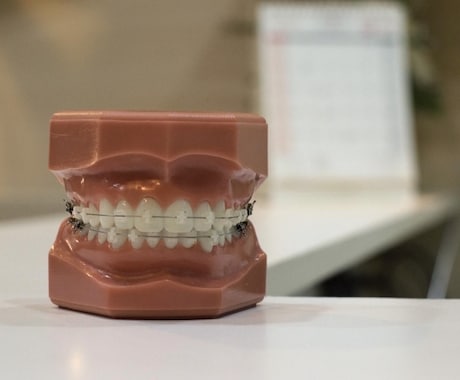 歯科矯正についてのお悩みお答えします 約400名のカウンセリングをしてきた現役歯科衛生士が教えます イメージ1