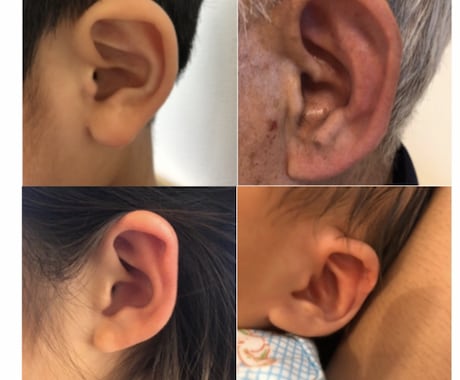 自律神経を整えスッキリ！耳つぼ健康法をお伝えします 施術人数述べ2,000人の経験から心やお身体のお悩みを解決 イメージ1