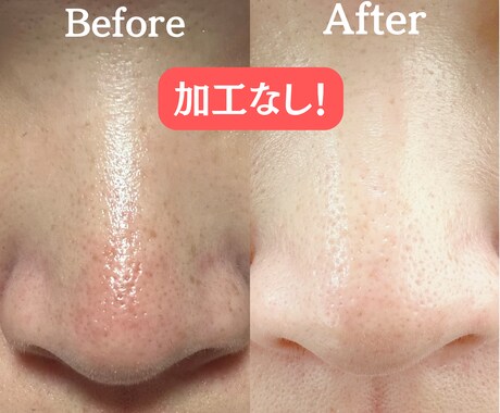 チャットで肌改善 個別相談（最大3日間）ができます 肌は十人十色！目指すはノーファンデ！ イメージ2