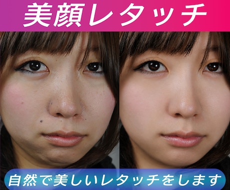 自然で美しいレタッチをします ホクロ・あざ・しわなどを除去しお肌を滑らかにレタッチします。 イメージ1