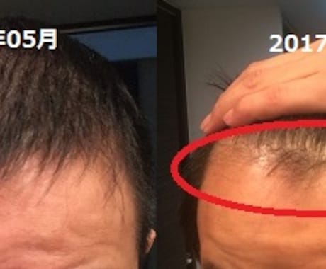 Amazon書籍で販売中の薄毛解消ノウハウあります 皮膚科と医薬品やサプリの輸入経験に基づく髪の毛の砂漠化改善法 イメージ2