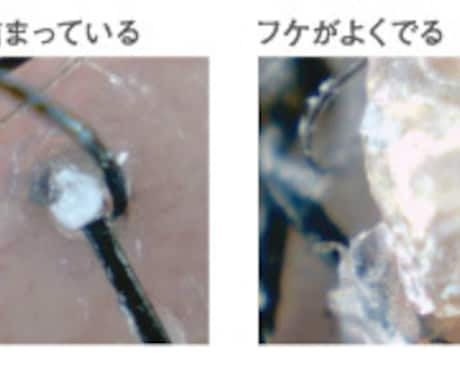 髪の抜け毛。育毛の100記事を提供します 髪の抜け毛。育毛の悩み格安2000円 イメージ1