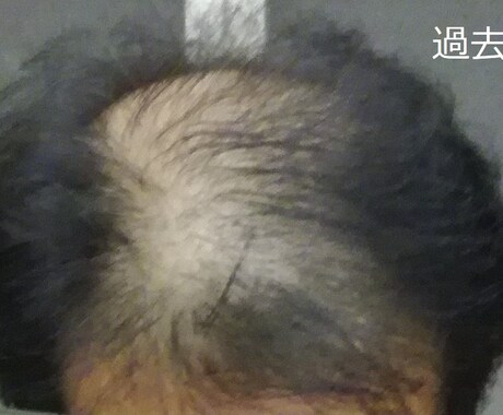 育毛についての悩みや質問にお答えします 薄毛で心に不安がある方のお悩みにお答えします イメージ2