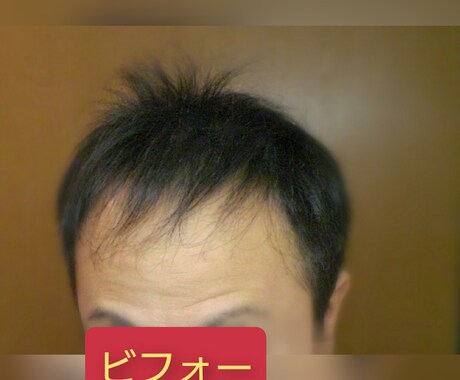 薄毛を克服した体験談を提供致します 薄毛は改善できます！私はハゲの悩みから解放されました！ イメージ2