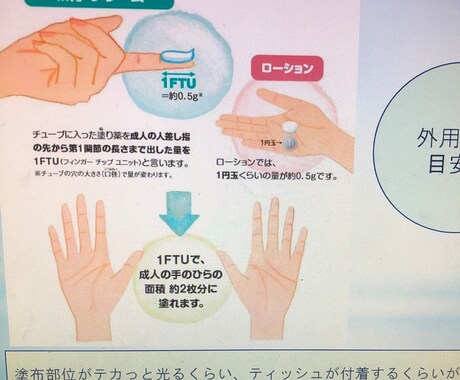 夏の感染症、皮膚炎パワーポイント資料提供します 保育園、小学校等での知識習得に イメージ2