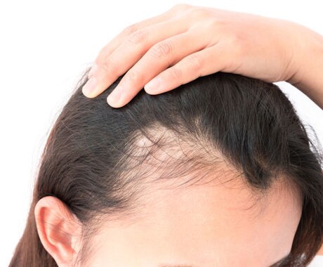 抜け毛！かゆみの原因は？簡単な頭皮診断をします 男女問わず自分に合うヘアケアを美容師以外から聞きたい方へ イメージ2