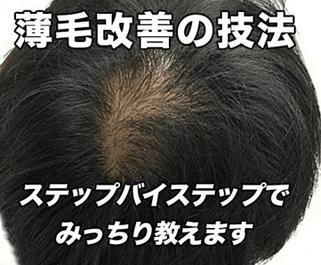 薄毛改善の方法を教えます 申し訳ありません...これでダメならもう元には戻せません イメージ1