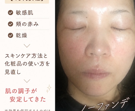 肌悩み改善 あなただけのスキンケアアドバイスします すっぴんに自信を持ちたい方へ あなただけのケア方法をご提案 イメージ2
