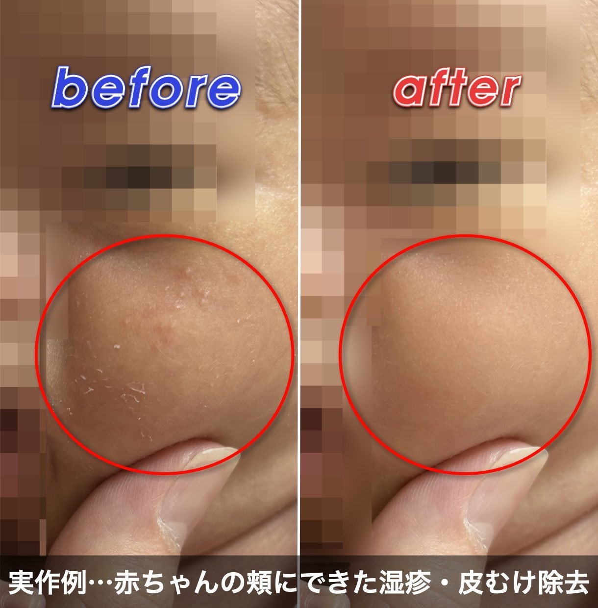 動画制作・動画編集・動画補正に丁寧・高品質に応ます 動画レタッチ|ぼかし|モザイク|テロップ|学術論文|動画広告 イメージ2