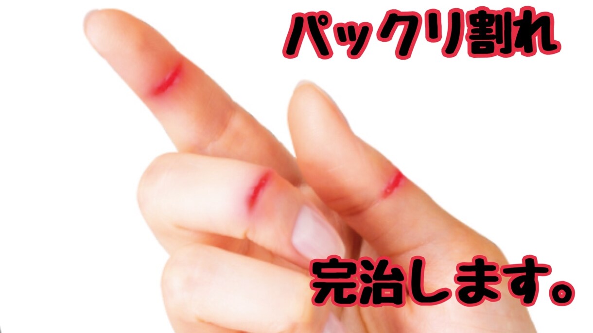 パックリ、ヒビ割れの治す方法をお教えします ひび、パックリ割れ痛いですよね。しっかり根完治しましょう。 イメージ1