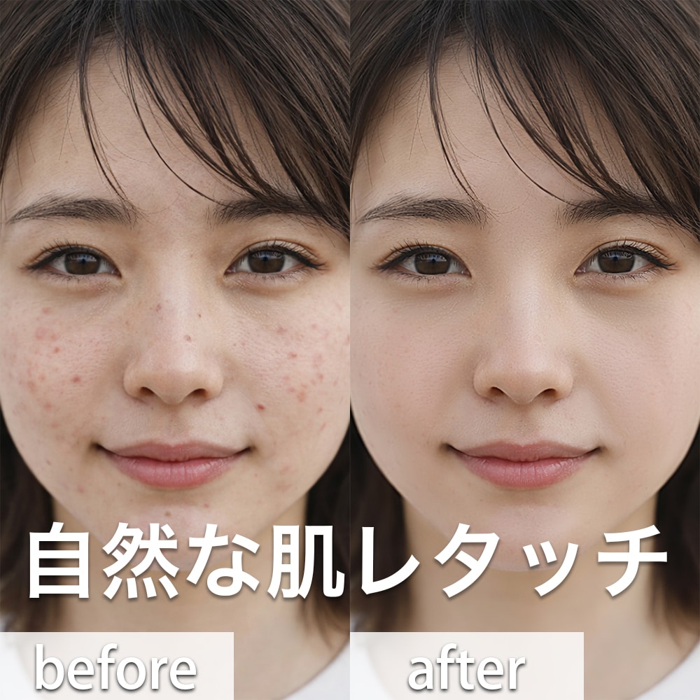 自然な肌レタッチ・ニキビや肌荒れを修正ます 満足いただけるまで無料で対応いたします イメージ2