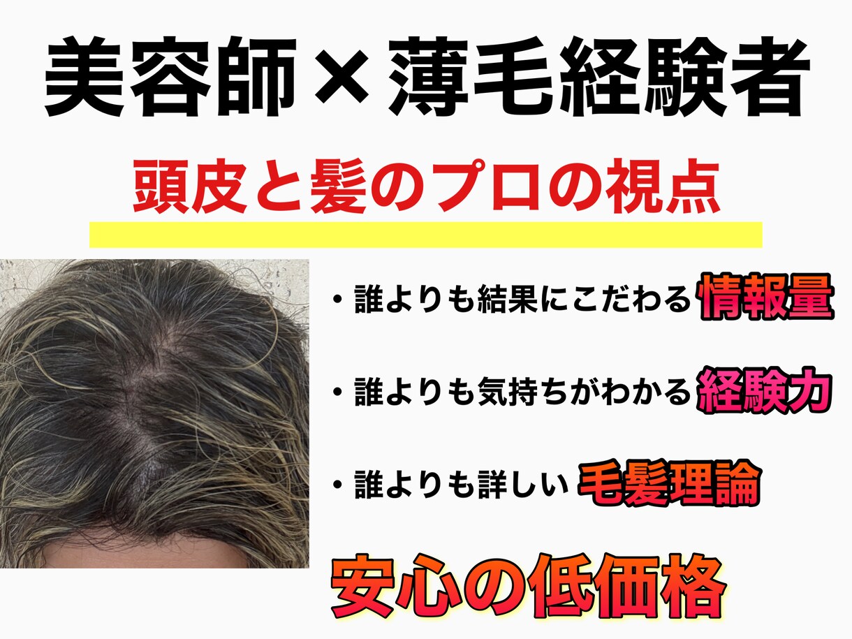 男性限定⚠️薄毛を改善させる方法をご提供いたします メンズの薄毛を徹底改善✨9割の増毛効果の実績✅ イメージ4