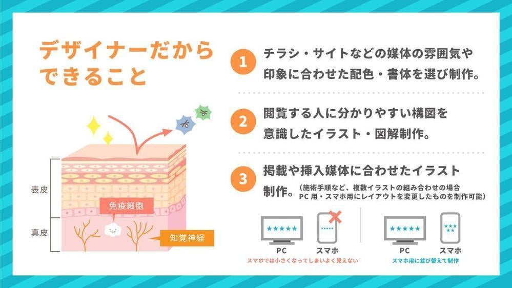 分かりやすい！伝わる！図解・解説イラスト制作します 整形外科・歯科・美容外科様など様々な図解イラストを作成 イメージ1
