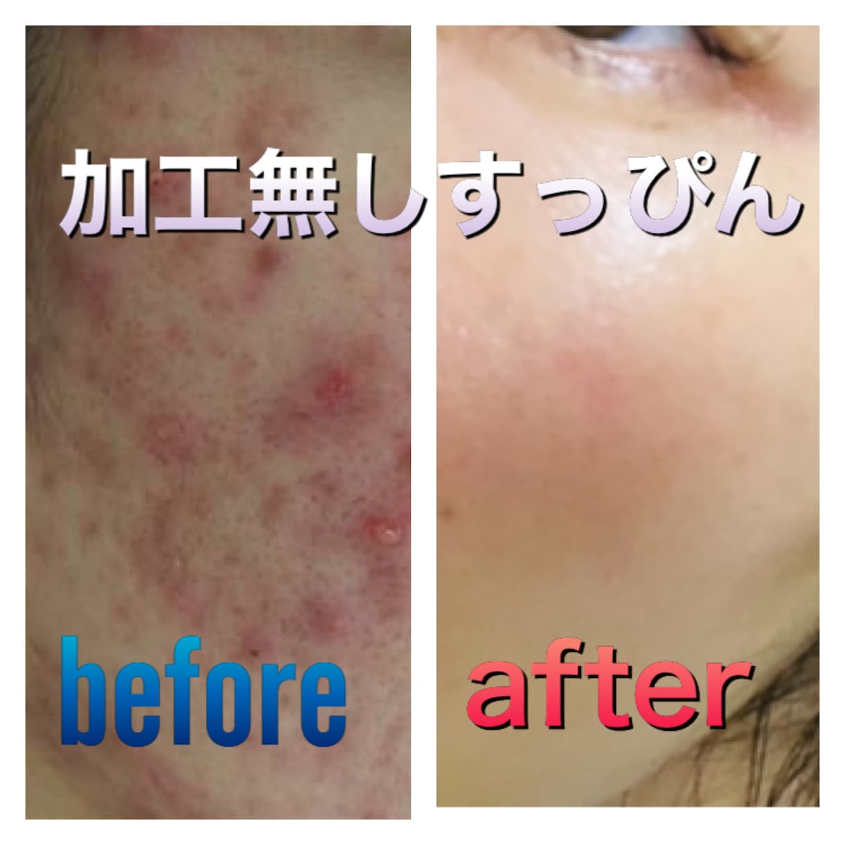 美肌の秘訣教えます ニキビ、敏感・乾燥肌、シミ…もう無駄なお金は使わないで下さい イメージ1