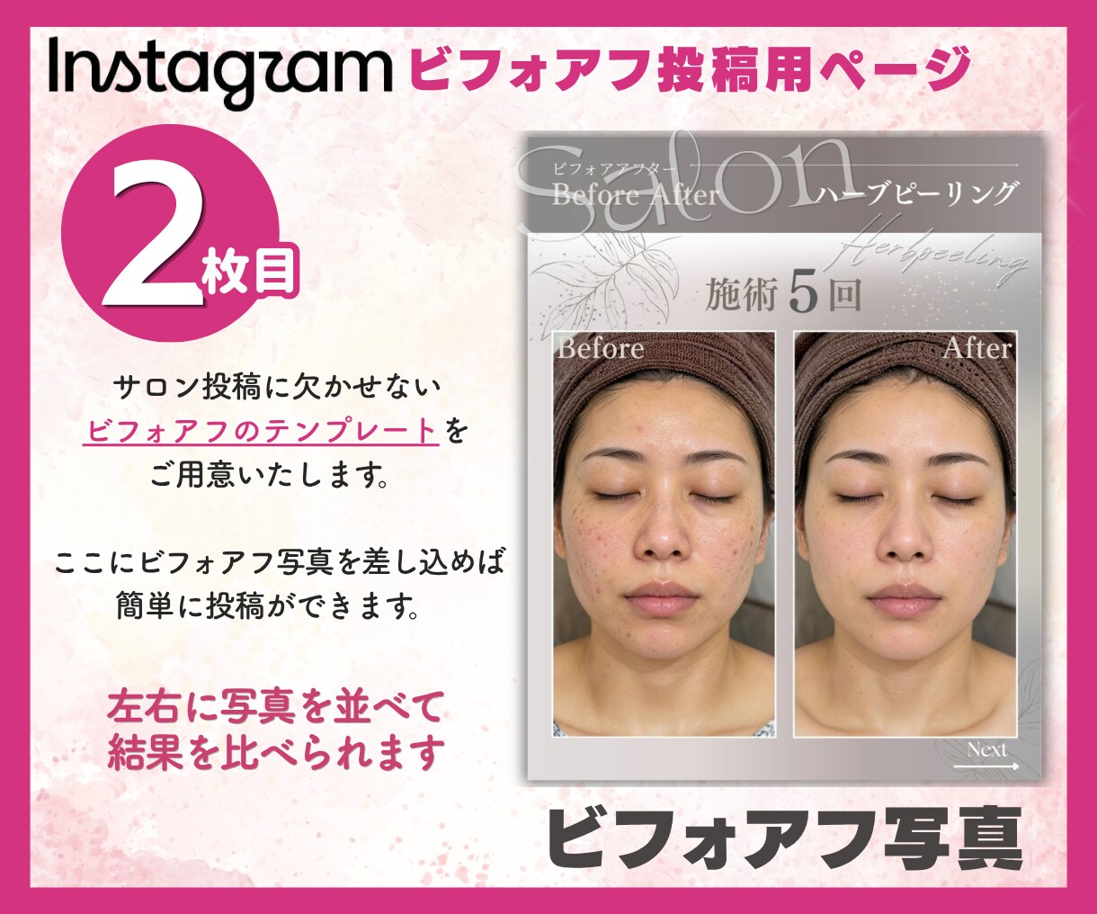 インスタ画像➡︎フィード投稿テンプレ3枚作成します 特別価格！AIじゃない！サロン向け女性目線世界観テンプレート イメージ3