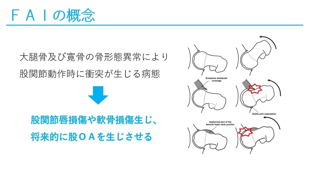 現役理学療法士が勉強会・学会発表の資料作成します 勉強会や発表でのパワーポイントでの資料作成いたします。 イメージ2