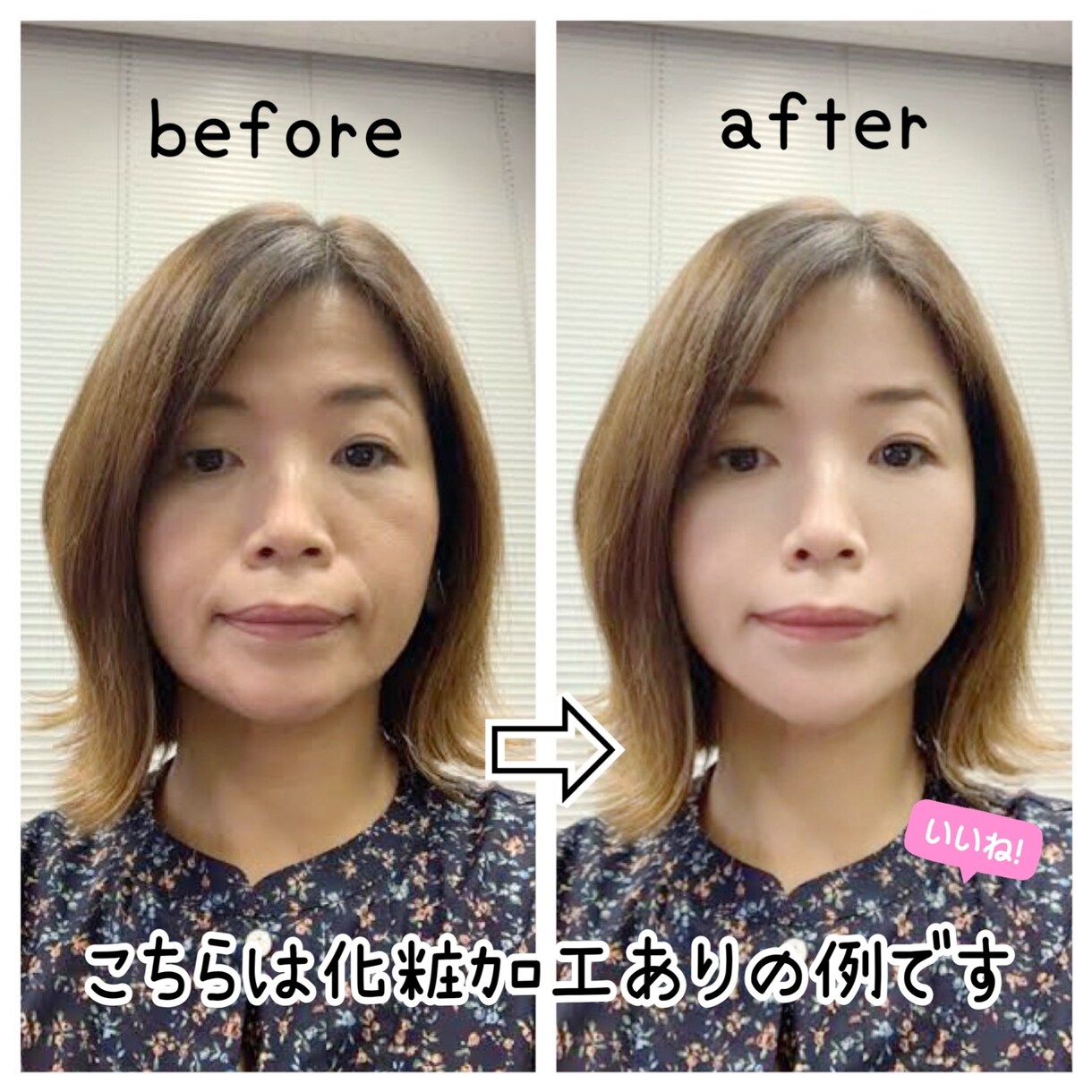 バレにくい！？人物写真の修正・加工受付ます その人、その人を生かした加工が得意です イメージ3